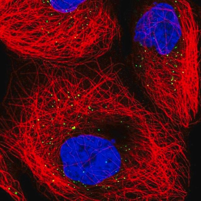 Anti-TRUB1 antibody produced in rabbit