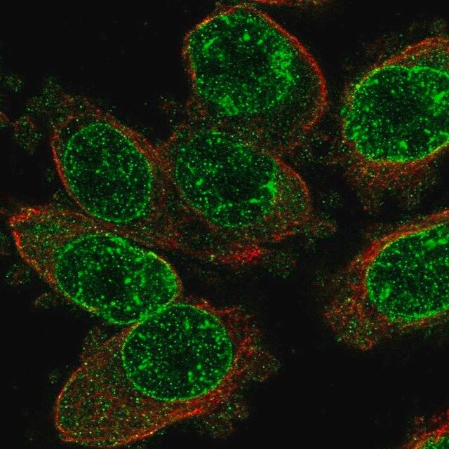 Anti-TRPM2 antibody produced in rabbit