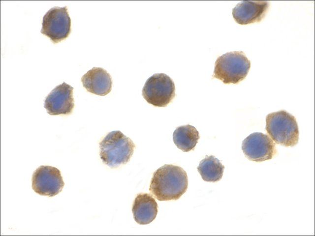 Anti-TSC1 (ab2) antibody produced in rabbit