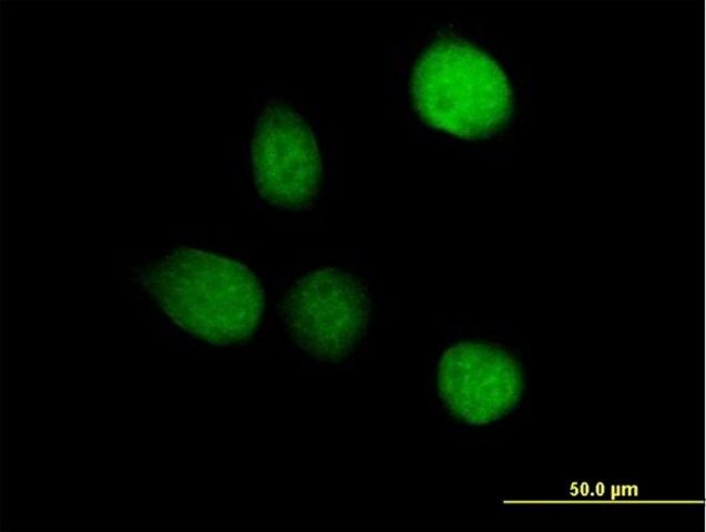 Anti-TSEN2 antibody produced in mouse