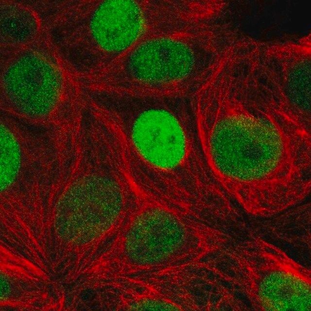 Anti-TRPS1 antibody produced in rabbit