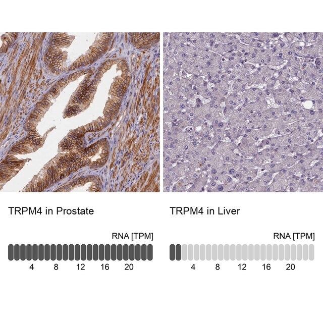 Anti-TRPM4 antibody produced in rabbit