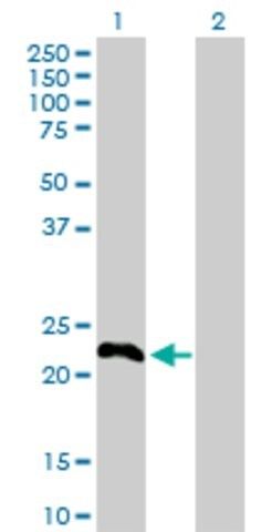 Anti-TSC22D3 antibody produced in rabbit