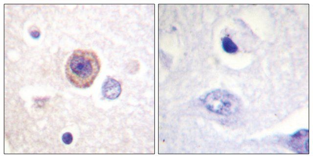 Anti-Tryptophan Hydroxylase, N-Terminal antibody produced in rabbit