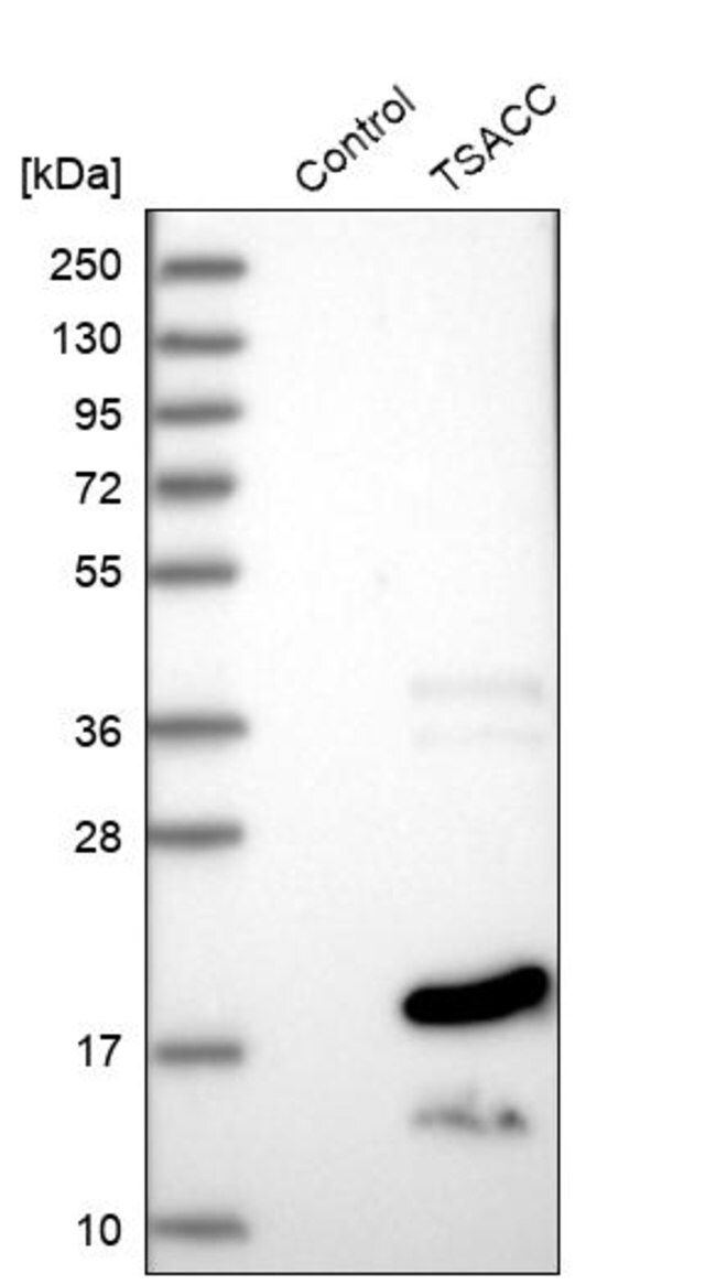 Anti-TSACC antibody produced in rabbit