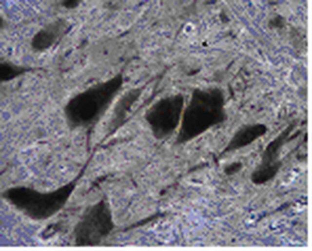 Anti-Tryptophan hydroxylase 2 Antibody