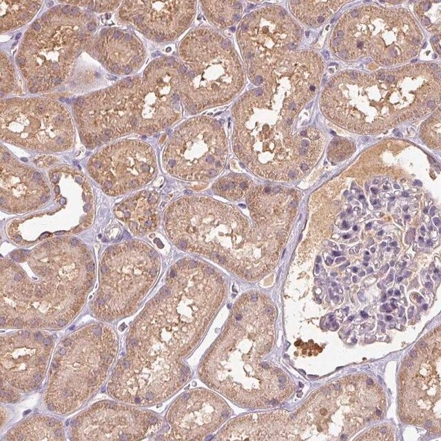 Anti-TSEN54 antibody produced in rabbit