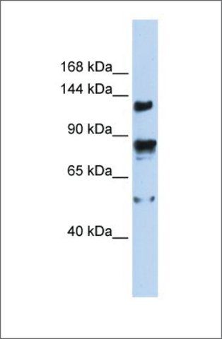 Anti-TRPM4 antibody produced in rabbit