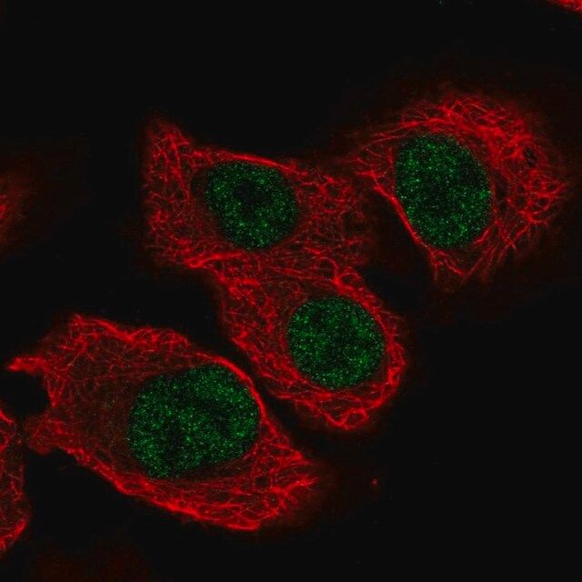 Anti-TSEN34 antibody produced in rabbit