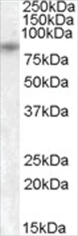 Anti-TRPV5 antibody produced in goat