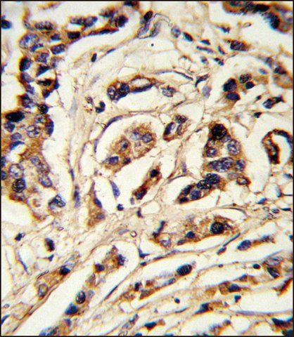 ANTI-TSHB (CENTER) antibody produced in rabbit