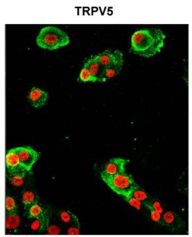 Anti-TRPV5 antibody produced in rabbit