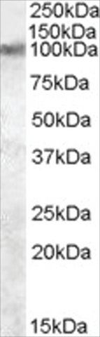 Anti-TRPV2 antibody produced in goat