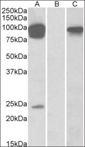 Anti-TRPV3 antibody produced in goat