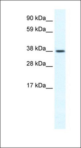 Anti-TRPM3 antibody produced in rabbit