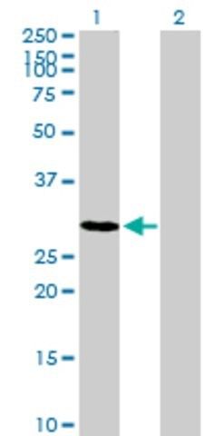 Anti-TSPAN17 antibody produced in mouse