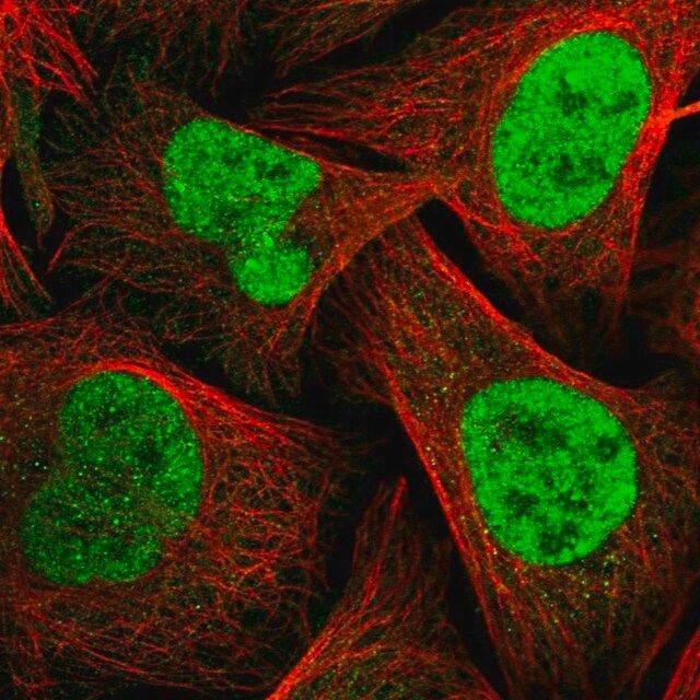 Anti-TOPBP1 antibody produced in rabbit