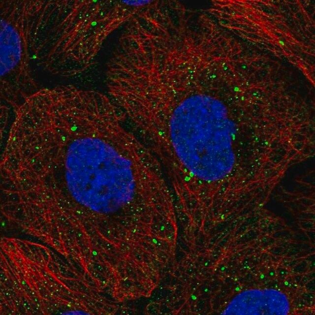 Anti-TOP3B antibody produced in rabbit