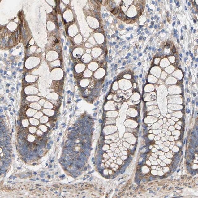 Anti-TOR1B antibody produced in rabbit