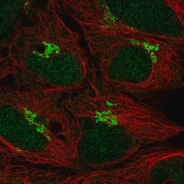 Anti-TP73 antibody produced in rabbit