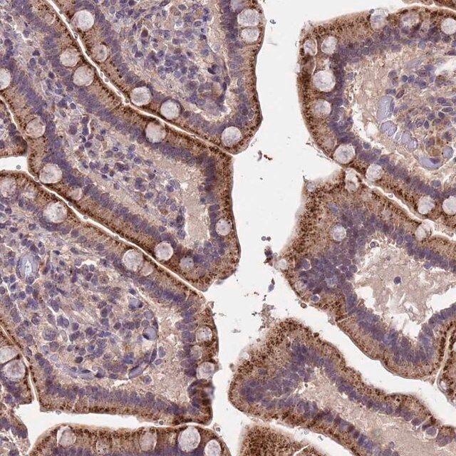 Anti-TOR4A antibody produced in rabbit