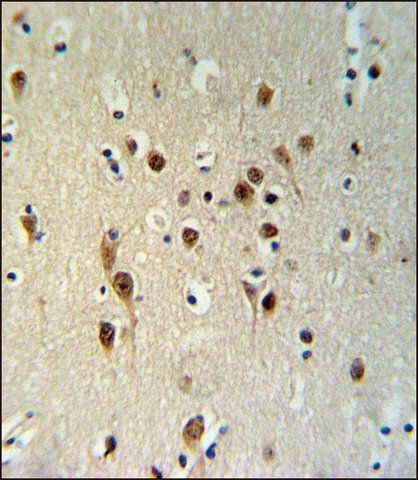 ANTI-TOX3 (CENTER) antibody produced in rabbit