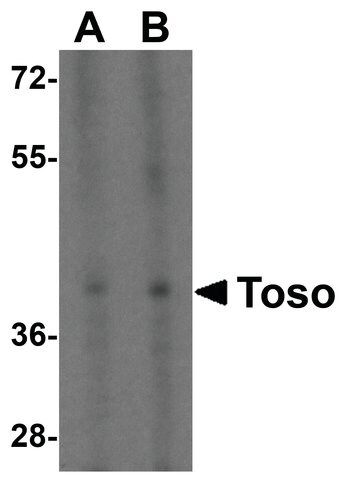 Anti-Toso antibody produced in rabbit