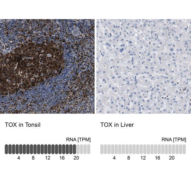 Anti-TOX antibody produced in rabbit