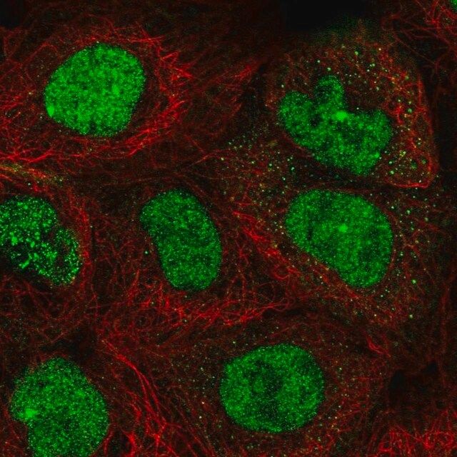 Anti-TOPBP1 antibody produced in rabbit