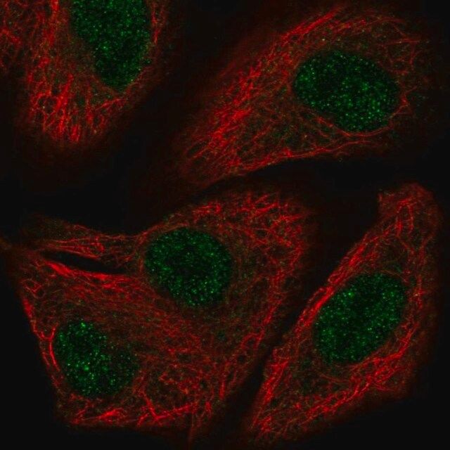 Anti-TOX2 antibody produced in rabbit