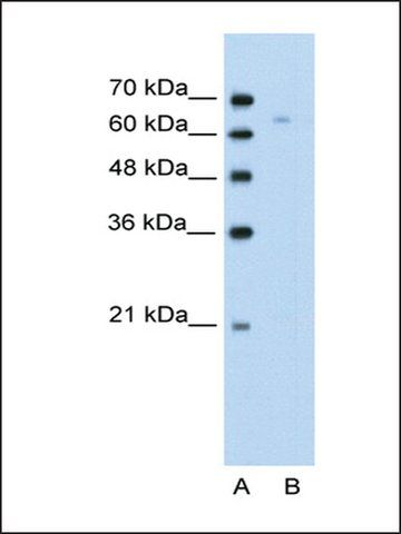 Anti-TOX antibody produced in rabbit