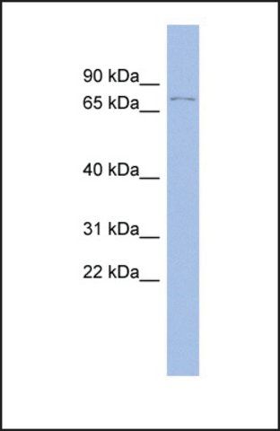 Anti-TP73 antibody produced in rabbit