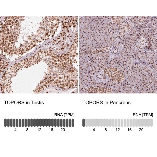 Anti-TOPORS antibody produced in rabbit