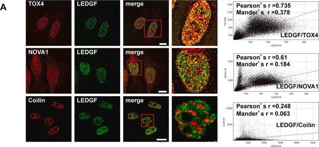 Anti-TOX4 antibody produced in rabbit