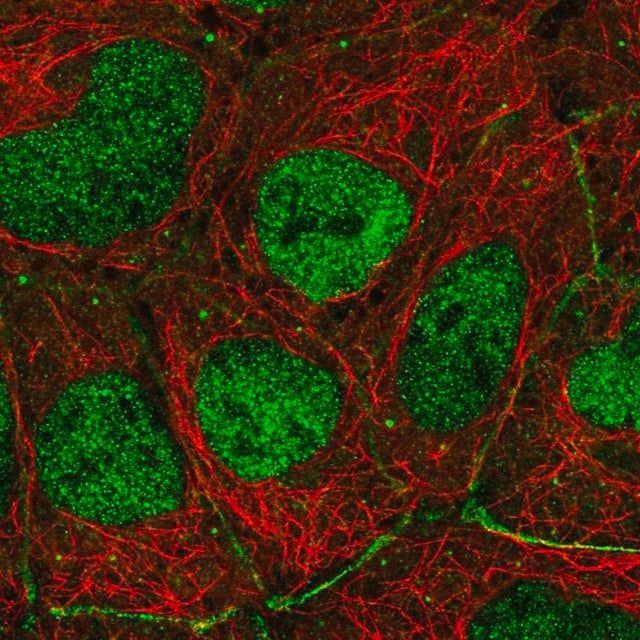 Anti-TP73 antibody produced in rabbit