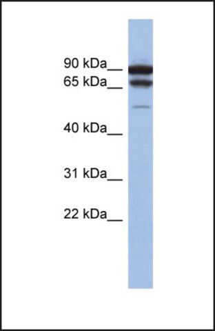 Anti-TP73 antibody produced in rabbit