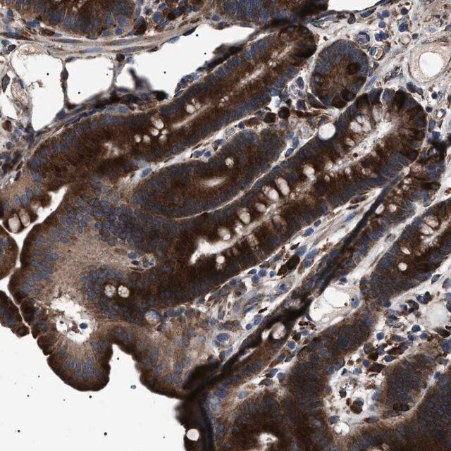 Anti-TOP1MT antibody produced in rabbit