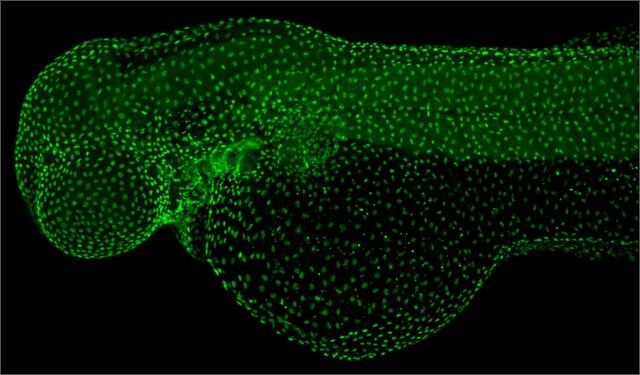 Anti-tp63 antibody produced in rabbit