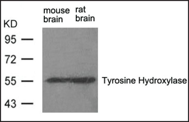 Anti-Th (Ab-31) antibody produced in rabbit