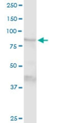 Anti-TGM1 antibody produced in rabbit