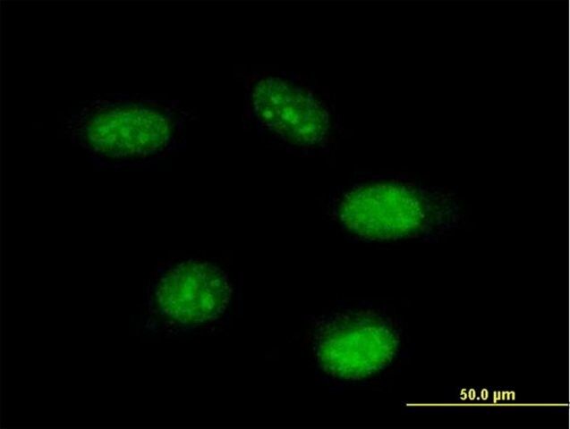 Anti-THAP11 antibody produced in mouse