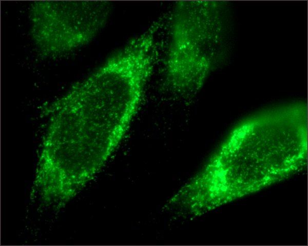 Anti-TFRC antibody produced in rabbit