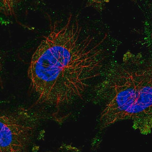 Anti-TGS1 antibody produced in rabbit