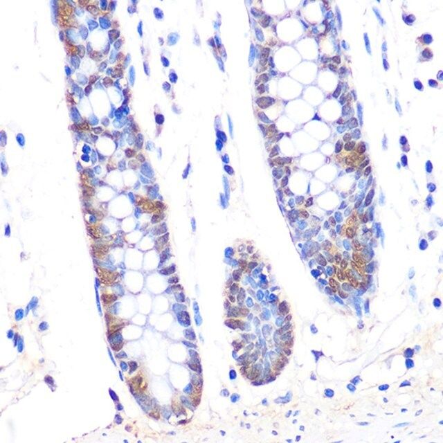 Anti-Thioredoxin 1 (Trx1/TXN) antibody produced in rabbit