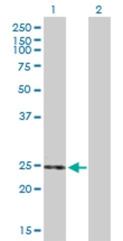 Anti-THEM5 antibody produced in mouse