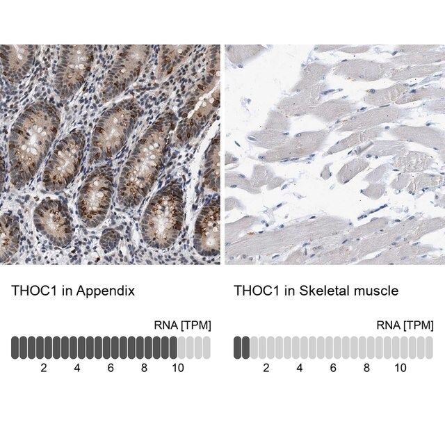 Anti-THOC1 antibody produced in rabbit