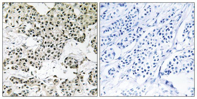 Anti-THOC5 antibody produced in rabbit