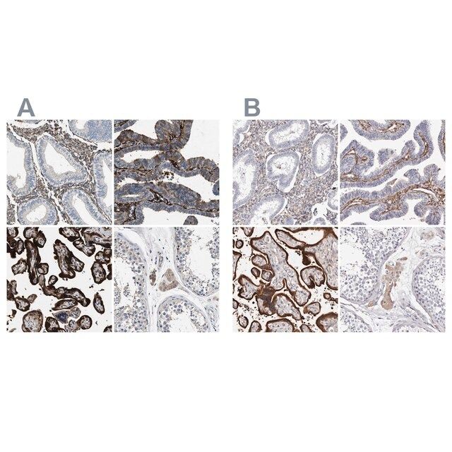 Anti-TGM2 antibody produced in rabbit