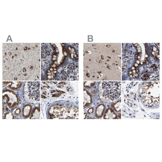 Anti-TGOLN2 antibody produced in rabbit