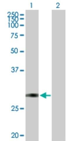 Anti-TFPI2 antibody produced in mouse